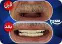 بیتوته
