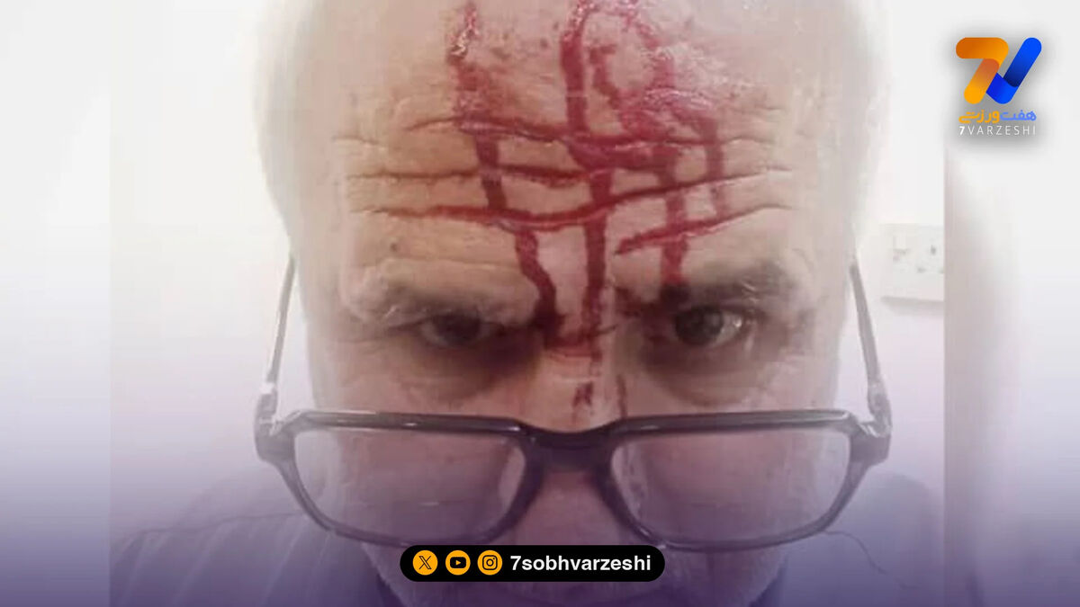 درگیری خونین در دفتر مدیرعامل باشگاه نفت و گاز گچساران