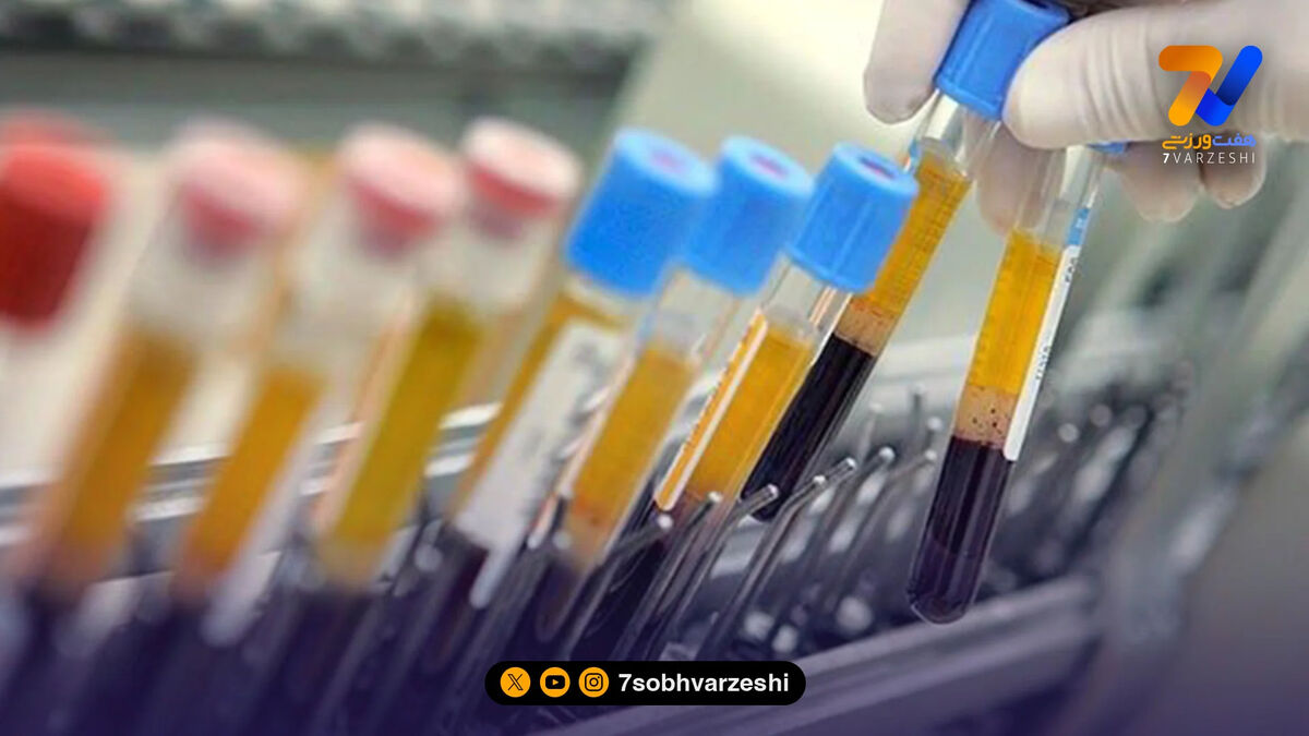 سه ورزشکار دوپینگی 12 سال محروم شدند!
