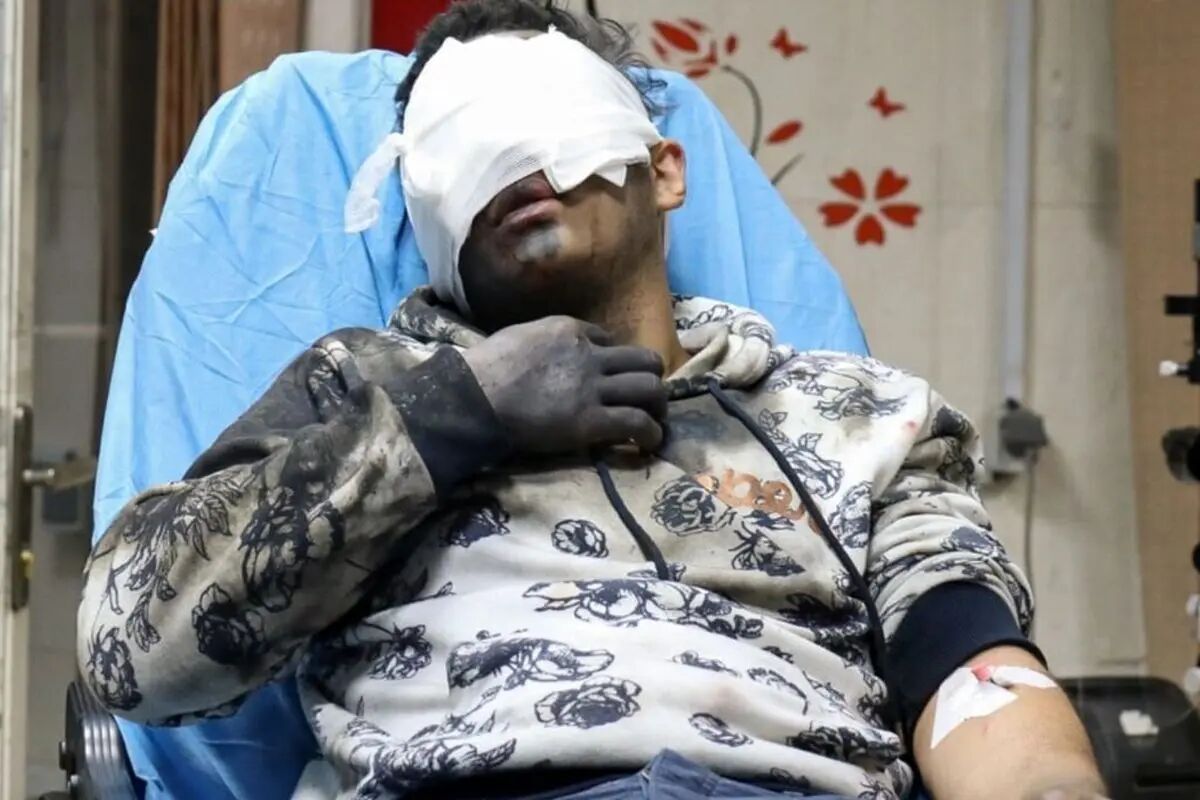 چهارشنبه سوری شروع نشده ۵ قربانی گرفت؛ ۱۵ نفر قطع عضو شدند