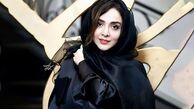 المیرا دهقانی چطور چهره شد؟