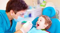 ملاحظات دندانپزشکی برای جویدن آدامس