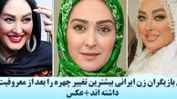 این بازیگران زن ایرانی بیشترین تغییر چهره را بعد از معروف شدن داشته اند+عکس