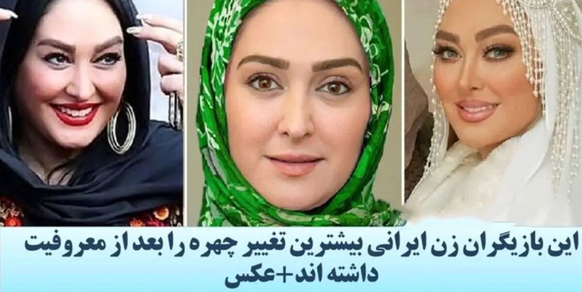 این بازیگران زن ایرانی بیشترین تغییر چهره را بعد از معروف شدن داشته اند+عکس