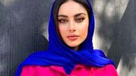تغییر چهره ترلان پروانه