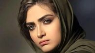 تغییر چهره دیدنی الناز سریال زخم کاری در سن 28 سالگی