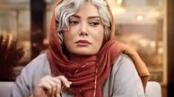 بوتاکس و تزریق ژل نگار فروزنده را زیبا‌تر کرد