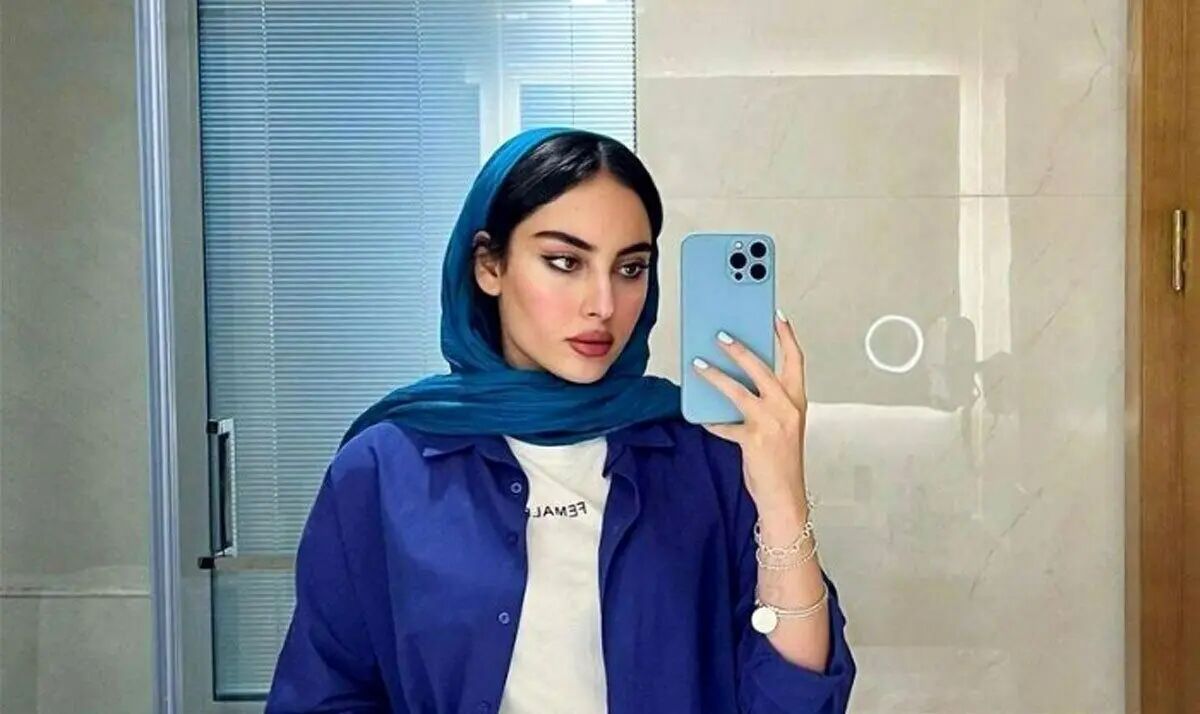 ترلان پروانه با چهره‌ای جدید