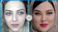 لیلا اوتادی قبل از عمل زیبایی