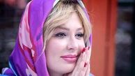 تغییر چهره قابل توجه نیوشا ضیغمی قبل و بعد از عمل زیبایی
