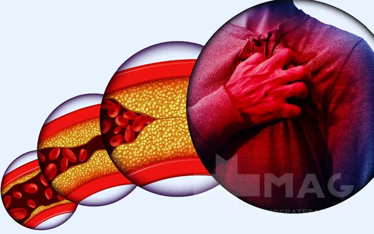 چربی خون را با این میوه معجزه‌کننده کنترل کنید