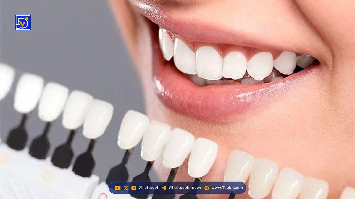 راز داشتن دندان‌های سفید