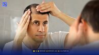 چهار توصیه مهم برای کسانی که ریزش مو دارند
