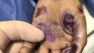 مرگ تلخ کودک 4 ساله بر اثر کودک آزاری