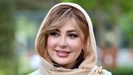 جدیدترین عکس نیوشا ضیغمی بعد از عمل دوباره بینی!