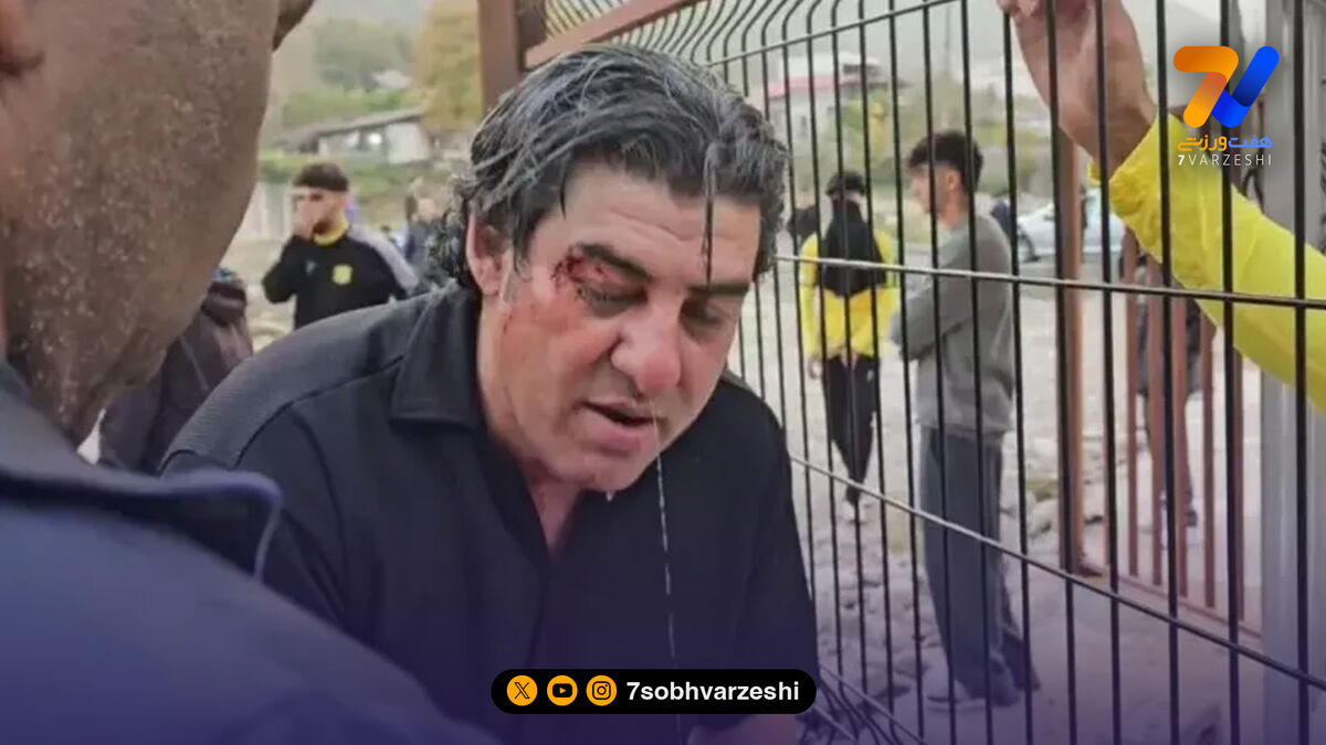 سراج: چنین جهنمی در عمرم ندیده بودم!