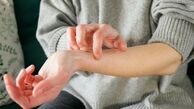 علت خارش بدن در طب سنتی + روش‌های درمان