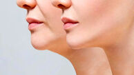 چه شوینده ای برای پوستم مناسبه ؟