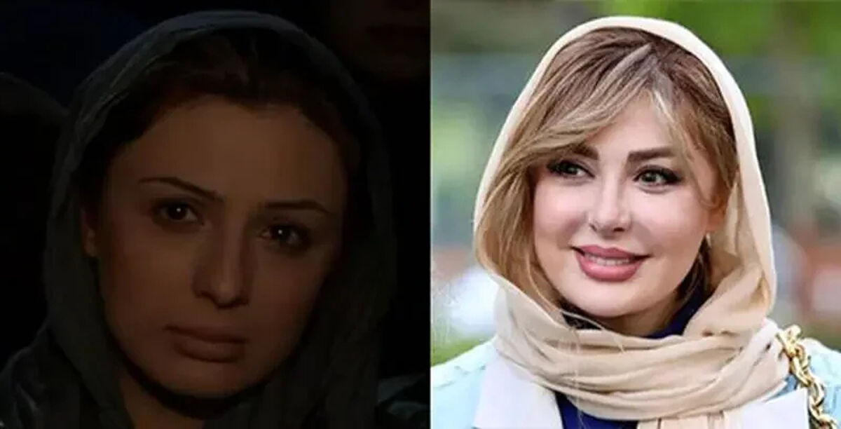 بازیگران زن ایرانی قبل از عمل زیبایی چه شکلی بودند؟/ عکس های جنجالی قبل و بعد!
